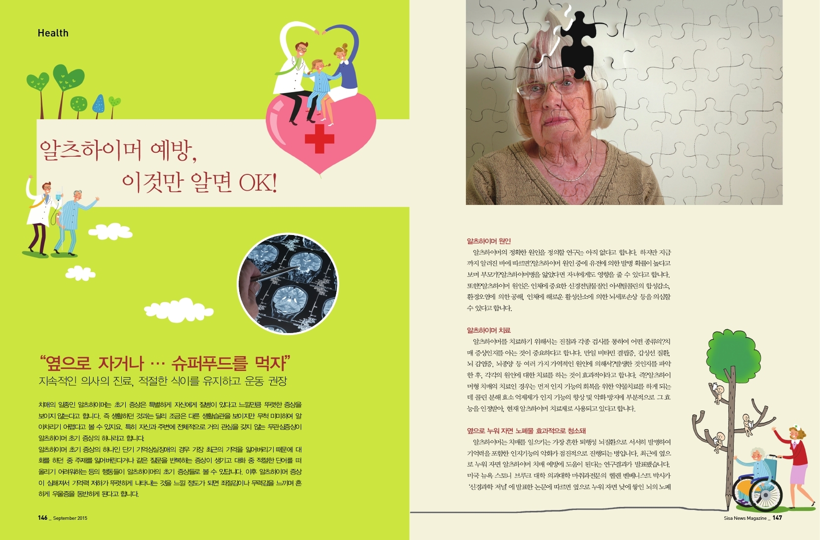 알프하이머 예방, 이것만 알면 OK!